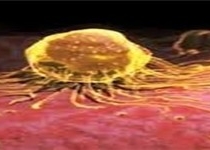 خانم ها بعد از 40 سالگی حتما ماموگرافی دوره ای انجام دهند