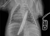 سگی که چاقو قورت داد+تصاویر