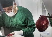 انجام عمل حساس تومور تیروئید در بیمارستان صحرایی سپاه+تصاویر