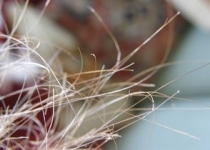 درمان طبی و فوری موخوره با مواد غذایی/ از اعجاز سس مایونز غافل نشوید