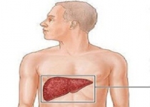 کارهایی که کبد شما را چرب می کند!