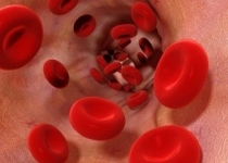 نسخه‌ای برای کاهش چربی‌خون/ خوردن گوشت قرمز را کم کنید