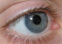 قدم سرطان روی چشم/ با دیدن این علائم در چشم ها باید به سرطان شک کرد!