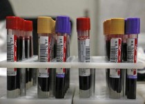 امسال بیش‌از 54هزار واحد خون در سیستان و بلوچستان اهدا شده است