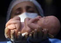 را‌زهایی از سقط جنین زیرزمینی؛ قتل با ۴ میلیون در کمتر از ۲ ساعت!