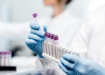 واکسن کرونا را تا پایان سال جاری میلادی به بازار عرضه خواهیم کرد