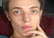 ابتلای پرستار جوان به ویروس کرونا با یک علامت بسیار عجیب