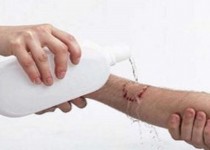 مرگ ۶ نفر بر اثر ابتلا به «هاری» در کشور