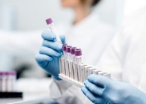 خبر تلخ سازمان جهانی بهداشت درباره واکسن کرونا