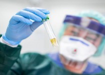 بهت‌آورترین حقایق درباره ابتلای مجدد به ویروس کرونا