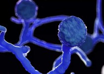 قارچ سیاه؛ دستیار مرگبار کرونا در موج دلتا/ چه کسانی در خطر ابتلا به این بیماری قارچی قرار دارند؟