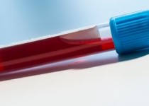 هوش مصنوعی مرگ بیمار مبتلا به کرونا را ارزیابی می‌کند