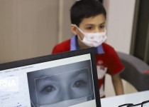 بهره مندی ۱۴۰ هزار کودک سیستان و بلوچستانی از خدمات غربالگری تنبلی چشم