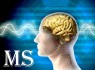 ۹۷هزار بیمار ام.اس در ایران / عوارض مستقیم تحریم‌ها بر درمان این بیماران