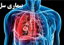 سیستان و بلوچستان رکوردار بیماری سل در کشور است/ کودکان و سالمندان گروه های پر خطر در معرض بیماری