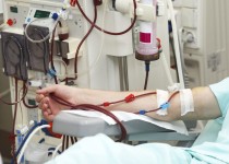 ۴۷۰ بیمار دیالیزی از خدمات دانشگاه علوم پزشکی زاهدان استفاده می‌کنند