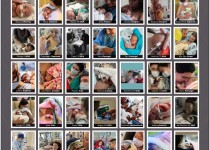 دانشگاه علوم پزشکی زاهدان جزو ۳۰ مرکز معتبر ارائه‌دهنده خدمات فوق‌تخصصی به نوزادان در جهان