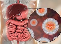 هپاتیت چالشی برای سلامت کبد