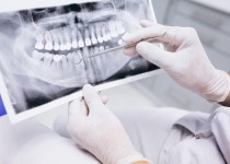 بی‌دندانی ۵۵ درصد از سالمندان بالای ۶۵ سال