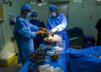 اهدای عضو بدن بدون چشم‌داشت